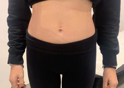 belly button piercing studio bologna